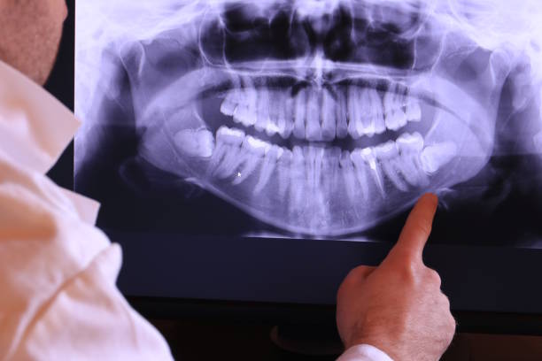 Best Broken or Cracked Tooth Emergency Dentist in Shell Point, SC