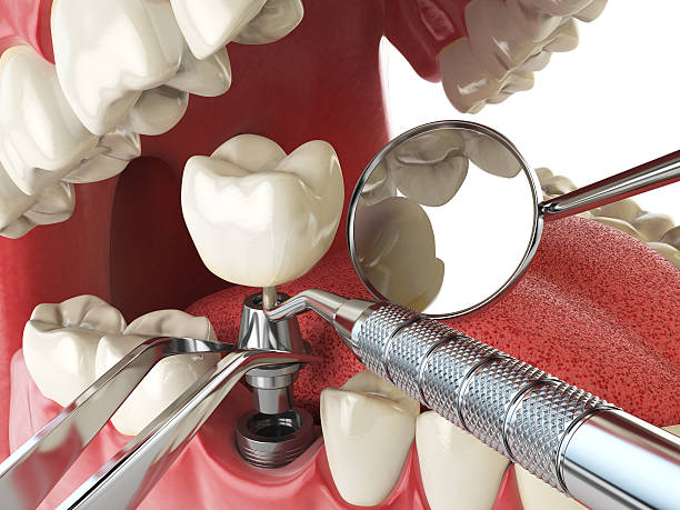 Best Orthodontic Emergency Dentist in Shell Point, SC